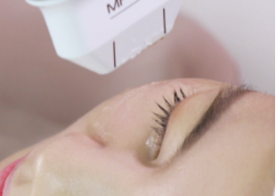 MPT施術イメージ